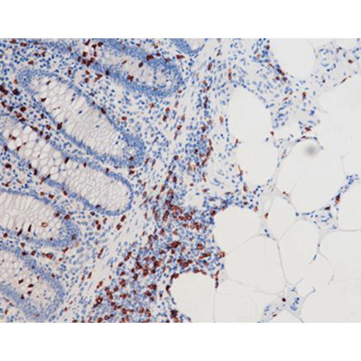 CD8